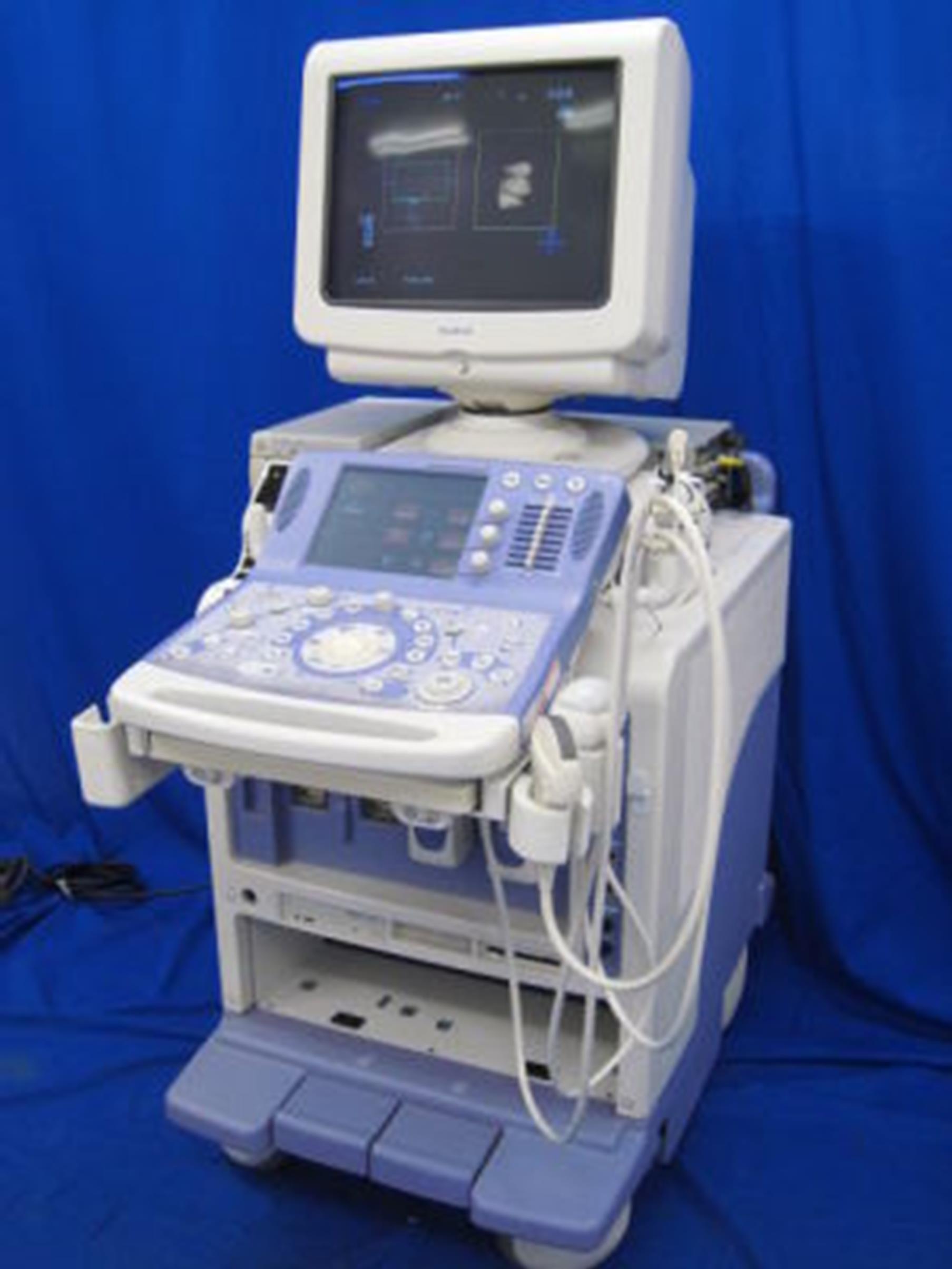 Pri sumu na karotidno bolezen opravimo ultrazvočno Dopplersko preiskavo